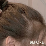 Hairloss Control Scalp Concentrate