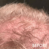 Hairloss Control Scalp Concentrate