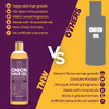 TNW-THE NATURAL WASH Onion Hair Oil | 100ml | 3.38 fl oz [Fit Tuber Recs]