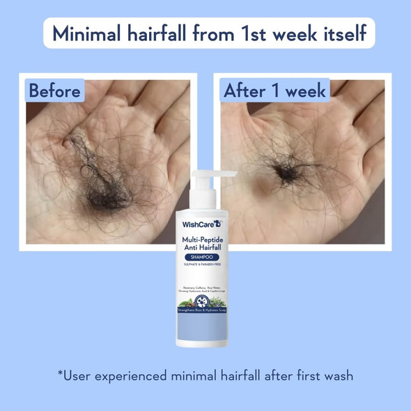 Multi Peptide Anti Hairfall Shampoo - Rice Water, Rosemary, Capilia Longa, Hyaluronic Acid & Caffeine|250 g|8.82 Oz