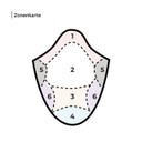 Maßgeschneiderte Folien-Haarsysteme