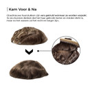 M101 Thin Skin Haarsystem für Männer