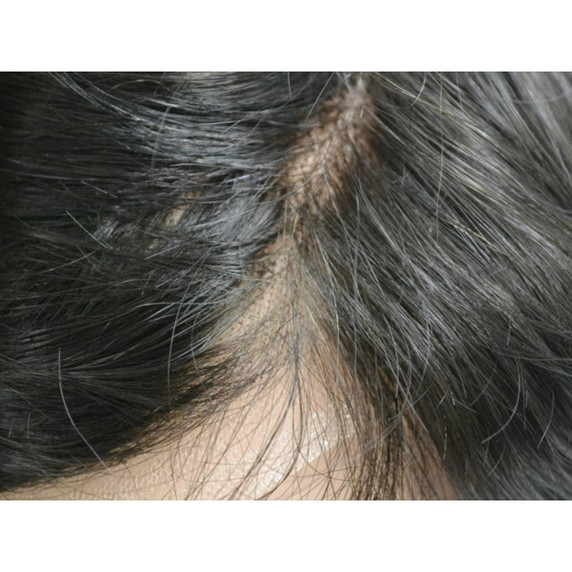 M105 Natürliche Haarlinie Toupet  für Männer