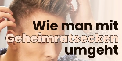 Wie man mit Geheimratsecken umgeht