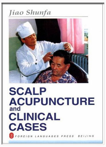Scalp Acupuncture and Clinical Cases
