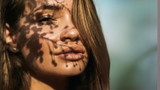 Hyperpigmentation: How To Prevent & Treat Dark Marks