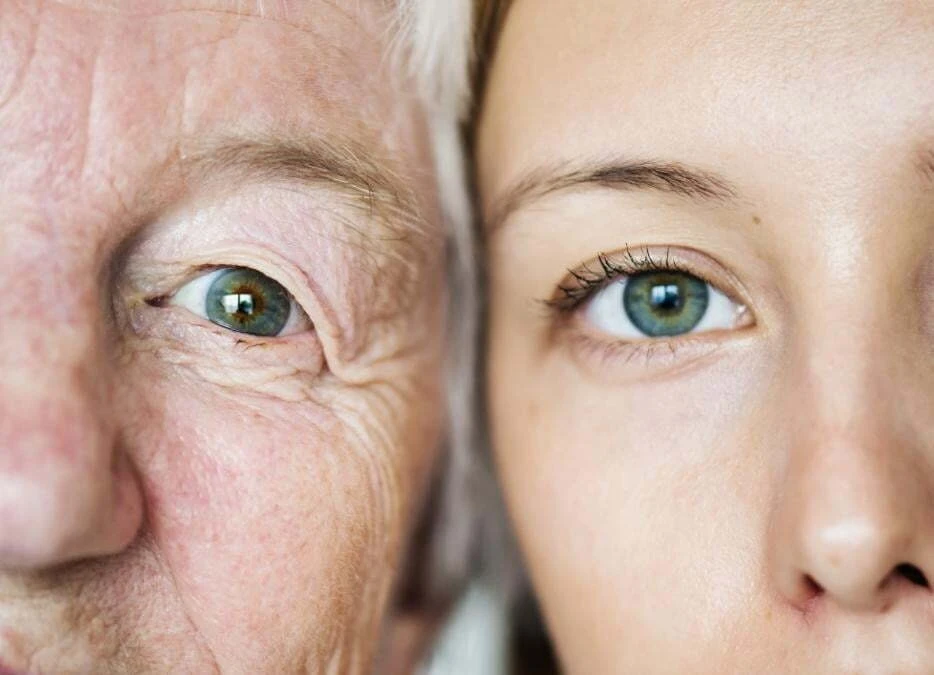 Skin collagen loss with age