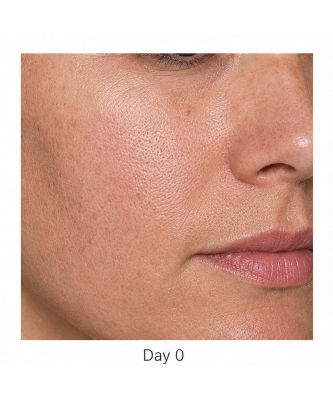Before treatment