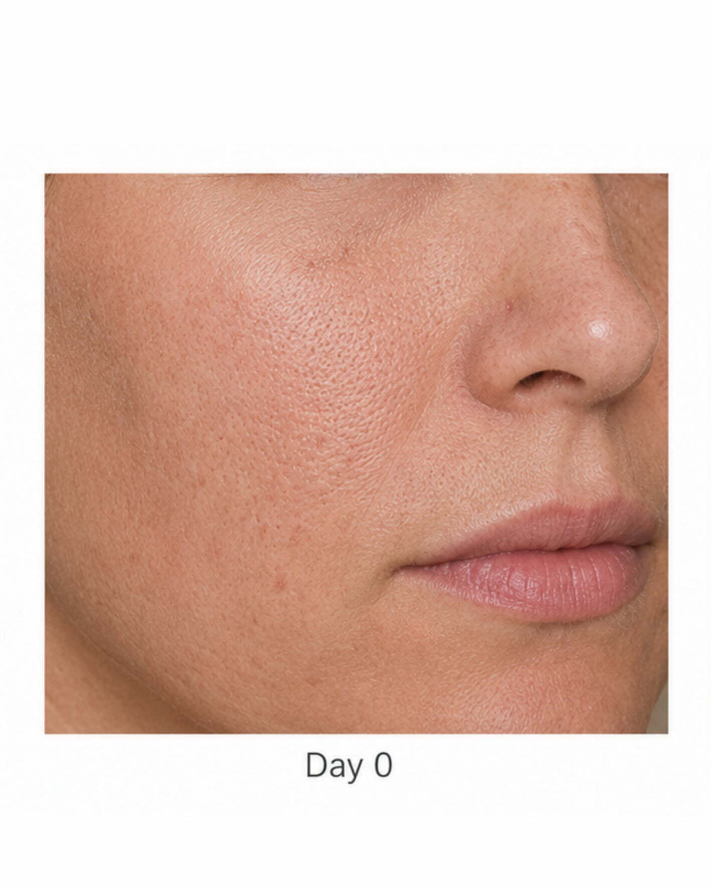 Before treatment