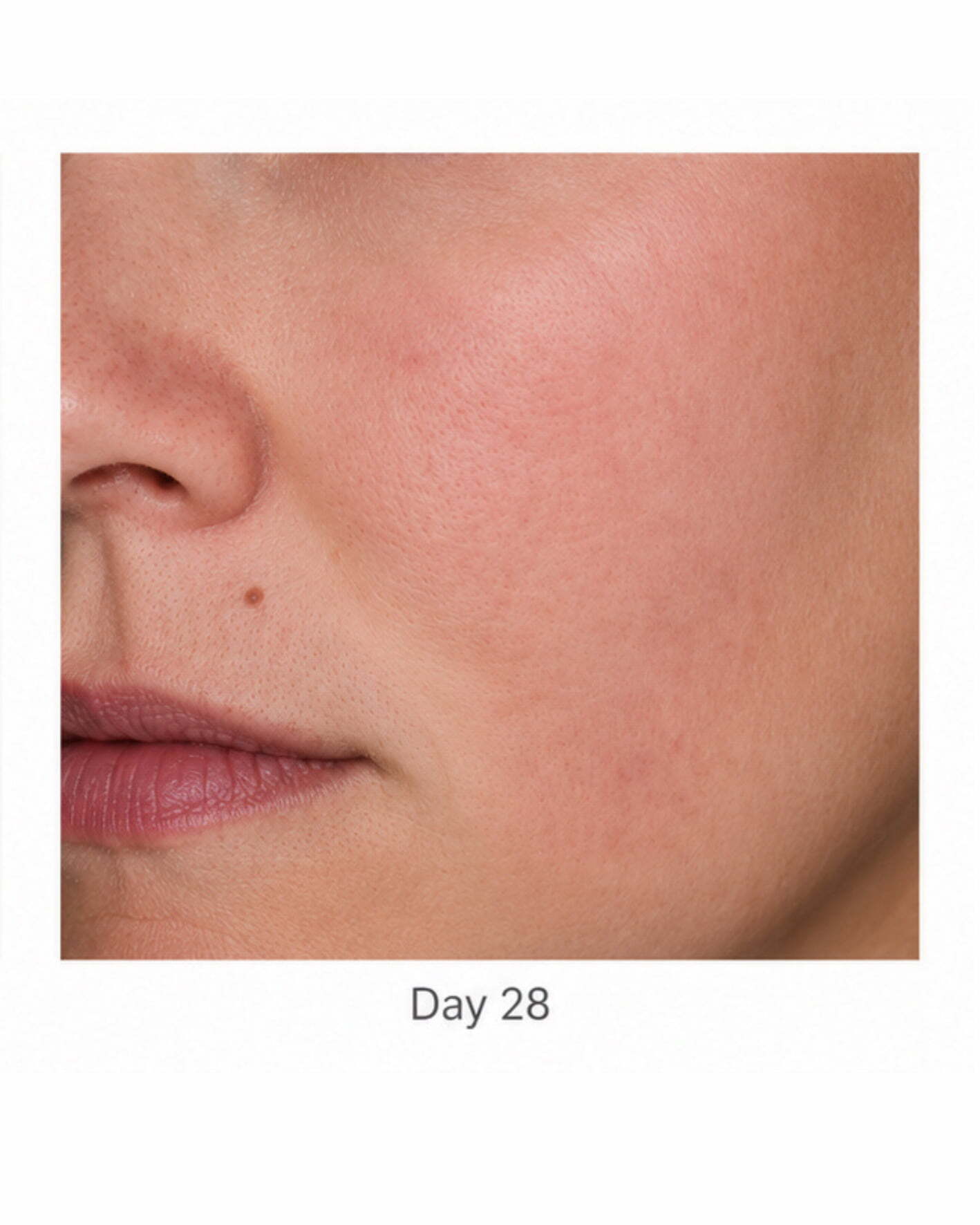 After 28 days