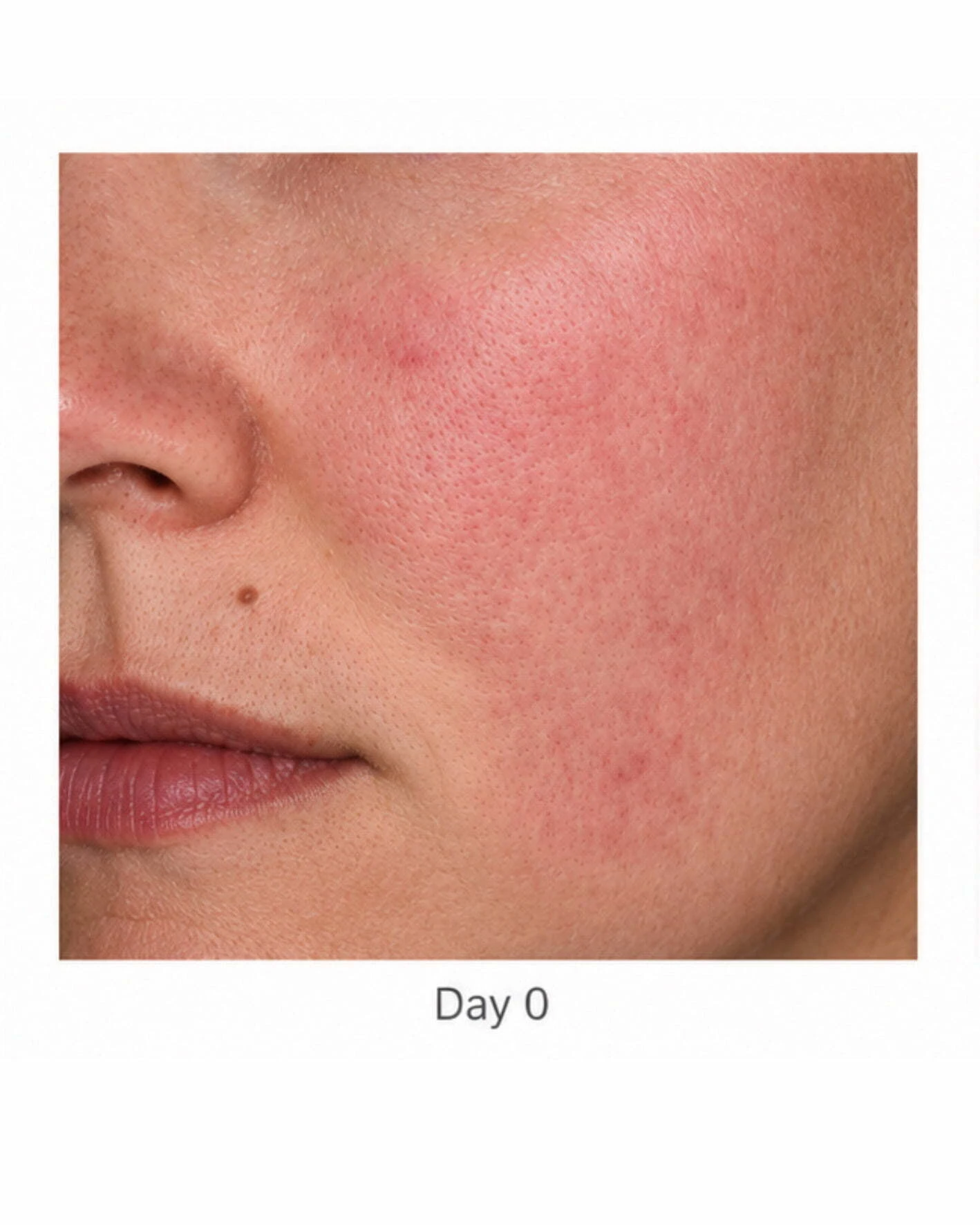 Before treatment