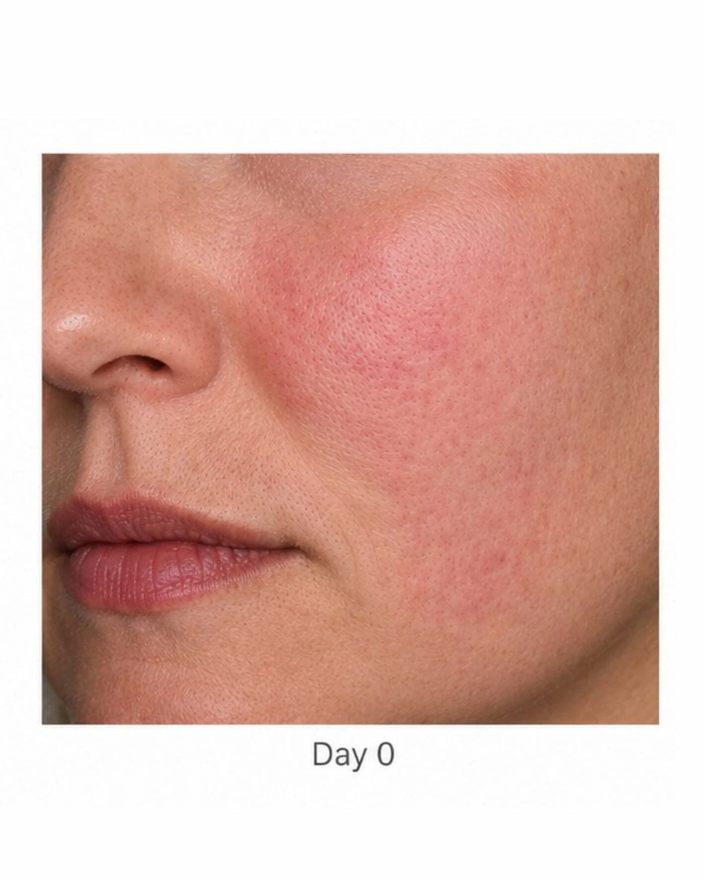 Before treatment