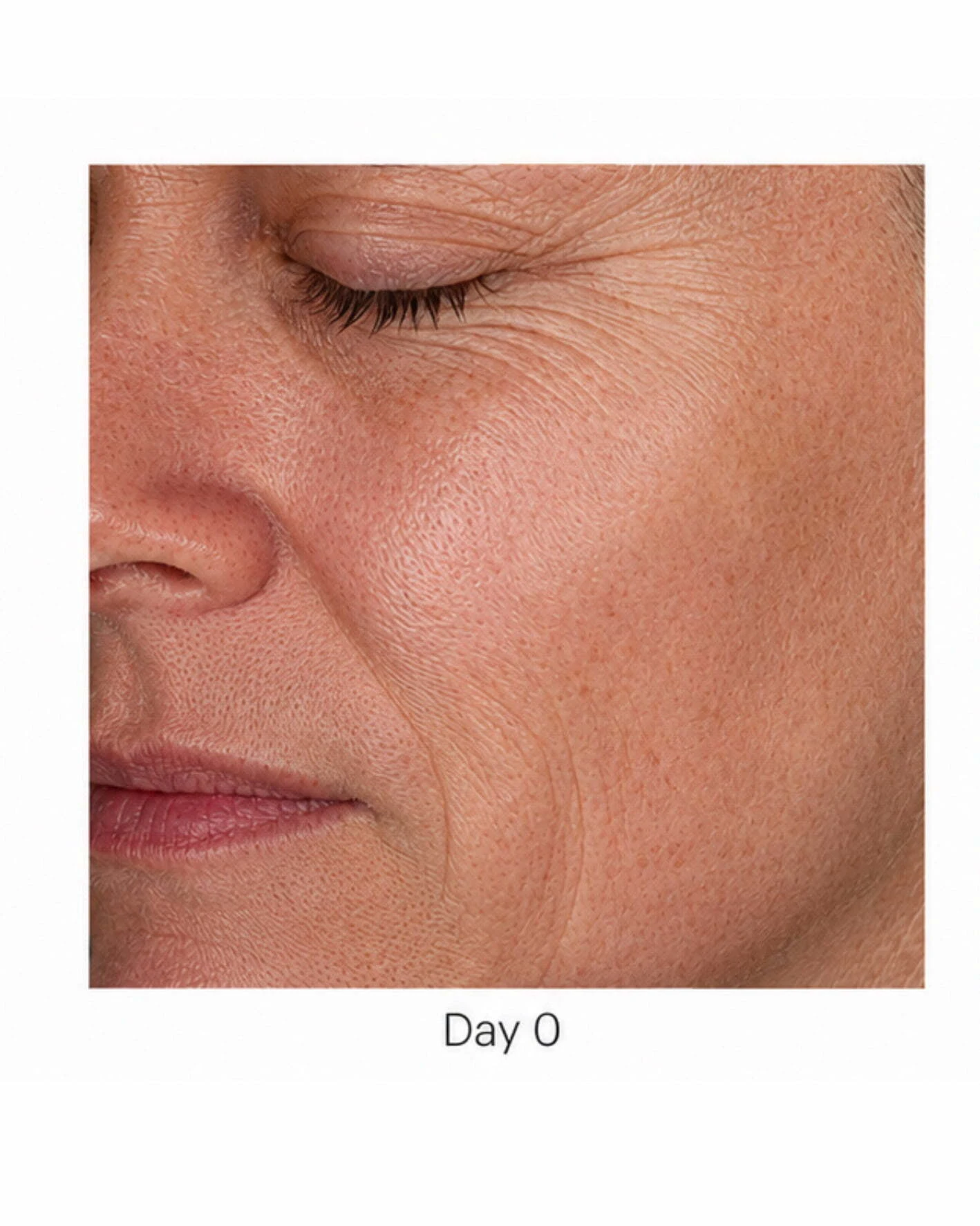 Before treatment