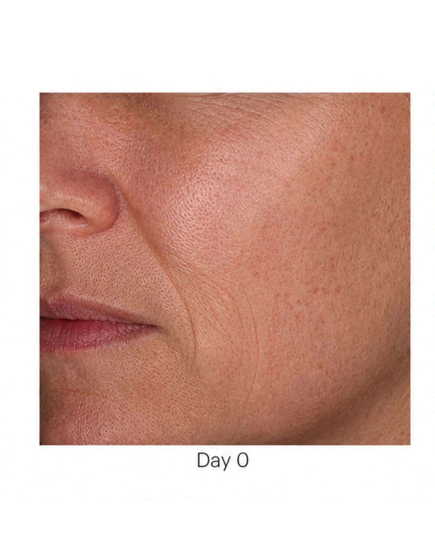 Before treatment