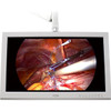 Foreseeson FS-P2603D