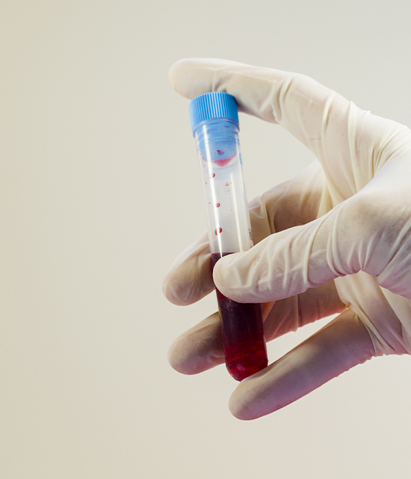 imagen servicio análisis grupo sanguíneo