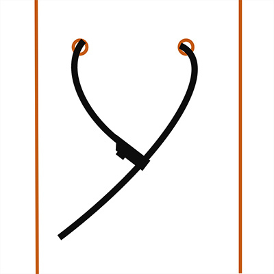Pre-fitted cable tie(s)