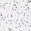 Epigenetics and Nuclear Signaling Antibodies 4 Anti-Acetyl-Histone H3-K18 Antibody CAB7257