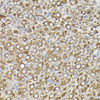 Immunohistochemistry analysis of paraffin-embedded Rat ovary using β-Tubulin Mouse mAb (CABC021) at dilution of 1:100 (40x lens). High pressure antigen retrieval performed with 0.01M Citrate buffer (pH 6.0) prior to IHC staining.