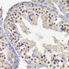 Anti-PI3 Kinase p85 beta [ARC0287] Monoclonal Antibody (CAB4860)