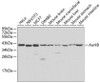 Anti-Aurora B Antibody (CAB1020)
