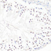 Anti-GLI1 Antibody (CAB14675)