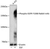 Anti-Phospho-EGFR-Y1068 [ARC0013] Monoclonal Antibody (CABP0027)