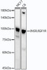 Anti-INSR/IGF1R [ARC54074] Monoclonal Antibody (CAB21984)