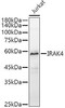 Anti-IRAK4 Monoclonal Antibody (CAB20839)