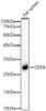 Anti-CD69 [ARC56158] Monoclonal Antibody (CAB22171)