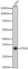 Anti-STING Antibody (CAB20175)
