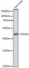 Anti-Parkin Antibody (CAB0968)