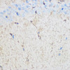Anti-S100B Antibody (CAB0676)