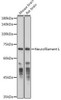 Anti-Neurofilament L [ARC50056] Monoclonal Antibody (CAB20269)