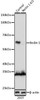 Anti-Beclin 1 Antibody -Knockout Validated (CAB7353)