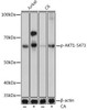Anti-Phospho-AKT1-S473 [ARC0169] Monoclonal Antibody (CABP0637)