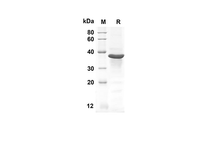 Recombinant Human GLI1 Protein(Trx Tag) (RPES8025) - Assay Genie Korea