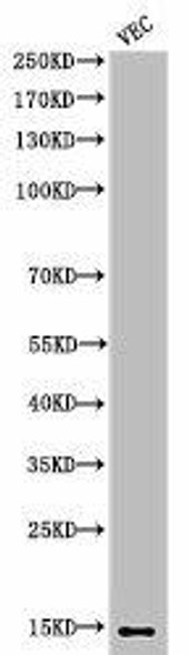 Acetyl-Histone H2B (K5) Antibody (PACO06047)