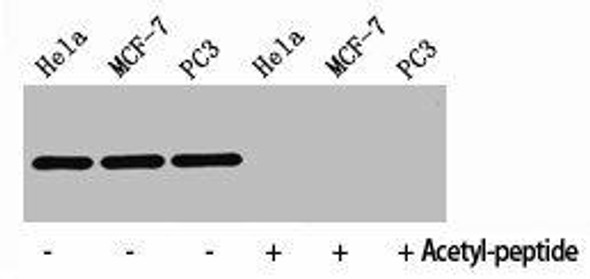 Acetyl-Histone H4 (K8) Antibody (PACO06051)