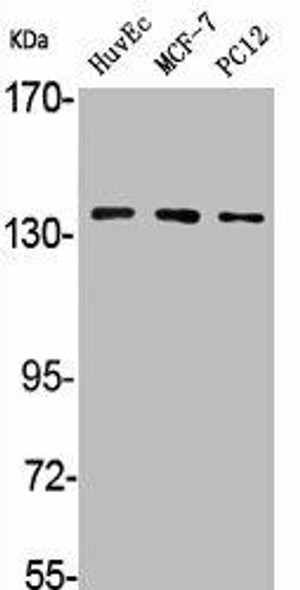 ADCY5/ADCY6 Antibody (PACO06212)