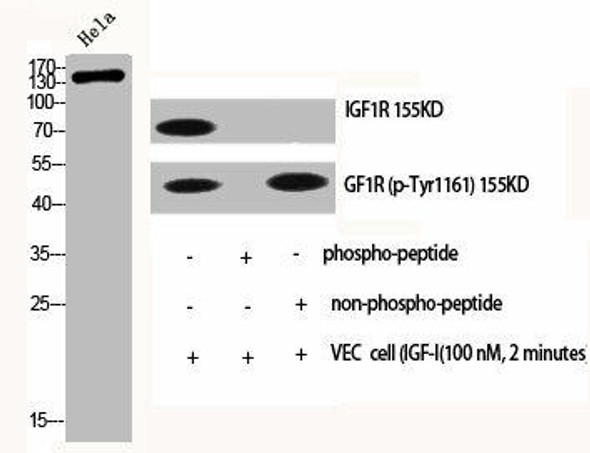 IGF1R/INSR Antibody (PACO06576)