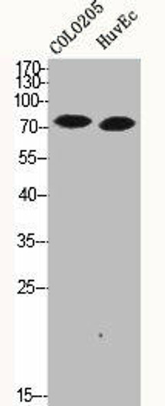 MAPK8IP1 Antibody (PACO06597)