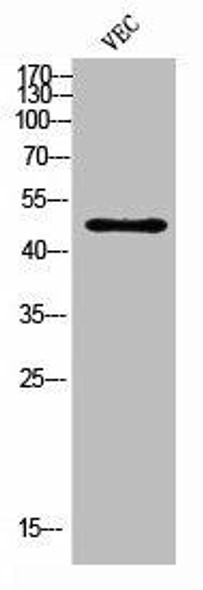 CSF2RA Antibody (PACO06871)