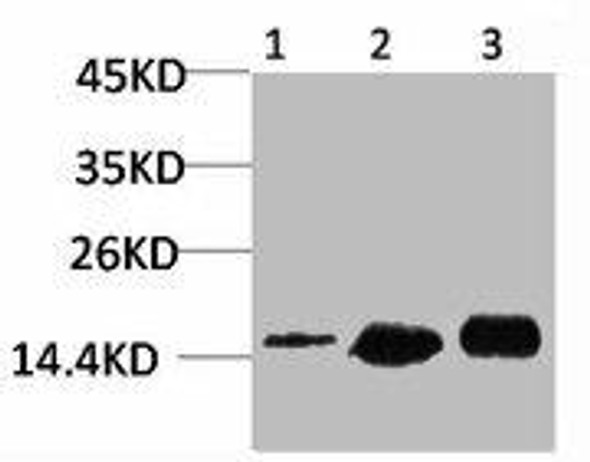 MAP1LC3B Antibody (PACO07010)