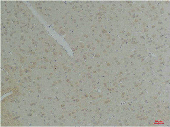 KCNK10 Antibody (PACO07181)