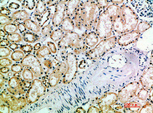 KIR3DL2 Antibody (PACO07364)