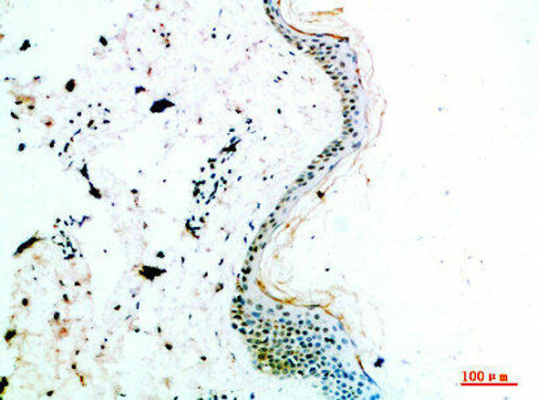 COL14A1 Antibody (PACO07399)