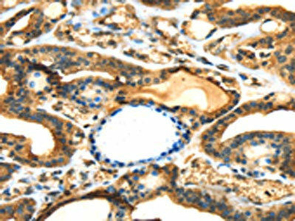 ANXA13 Antibody (PACO14044)