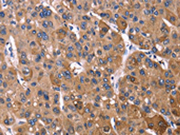 KIR2DL3/KIR2DL1/KIR2DL4/KIR2DS4 Antibody (PACO15954)