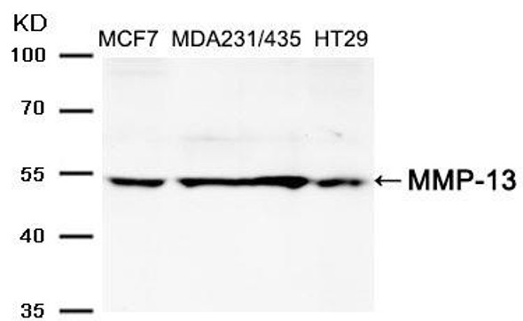 MMP13 Antibody (PACO21578)